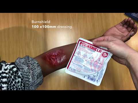 Load and play video in Gallery viewer, Burn bandage Burnshield 10x10cm
